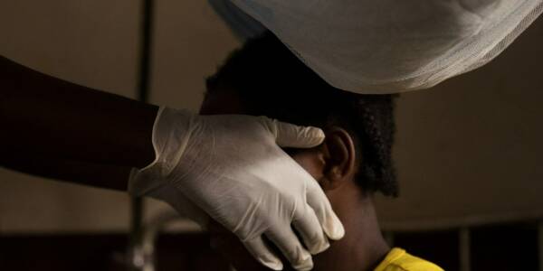 La variole du singe est une maladie rare originaire d'Afrique.