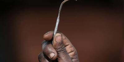 Plus de 230 millions de survivantes de mutilations génitales dans le monde, déplore l'Unicef