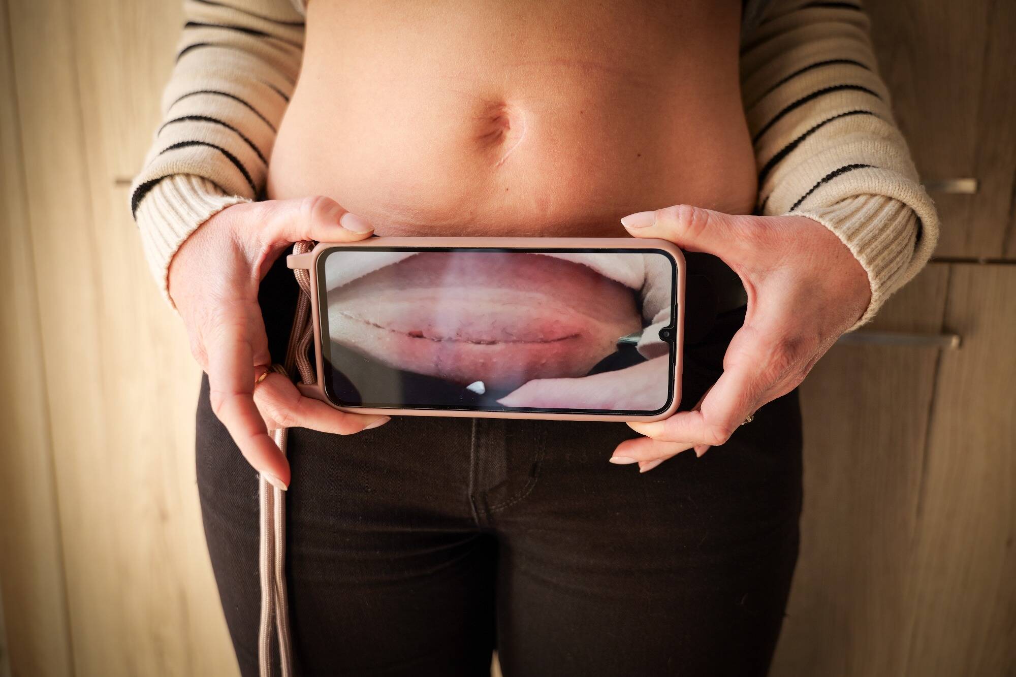 "Je n'avais jamais ressenti une douleur aussi intense": victimes de violences gynécologiques et obstétricales, elles témoignent de leurs souffrances invisibilisées