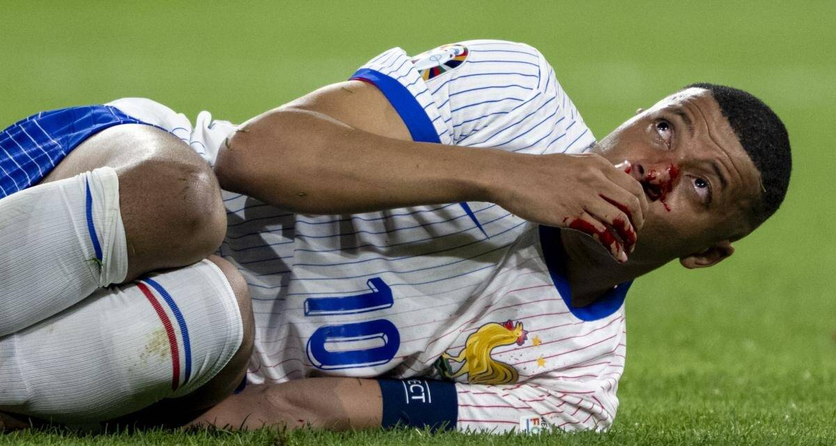 Gravité, indisponibilité, la décla de Giroud... Ce que l'on sait sur la blessure de Kylian Mbappé au lendemain du match face à l'Autriche