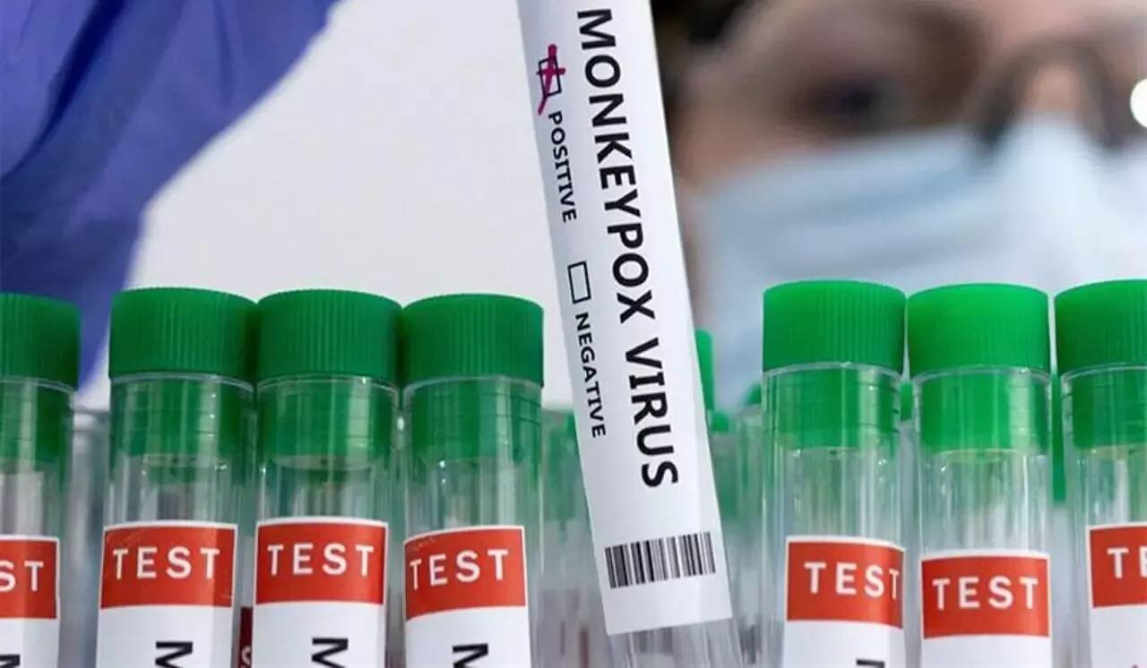 Epidémie de variole du singe: un "bien meilleur scénario" que le Covid se félicite l'Alliance du vaccin