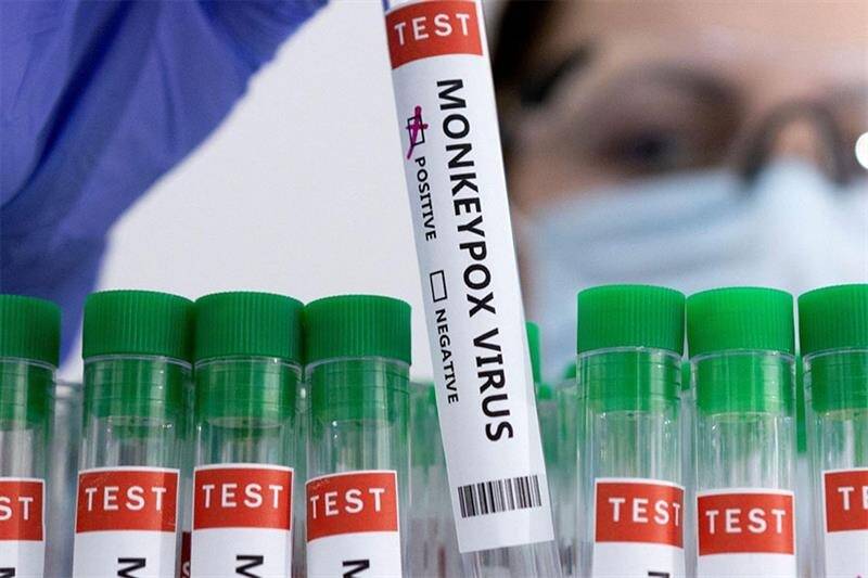 Premier cas en Europe, nouvelle souche plus contagieuse, alerte de l'OMS... On fait le point sur l'épidémie de variole du singe (mpox)