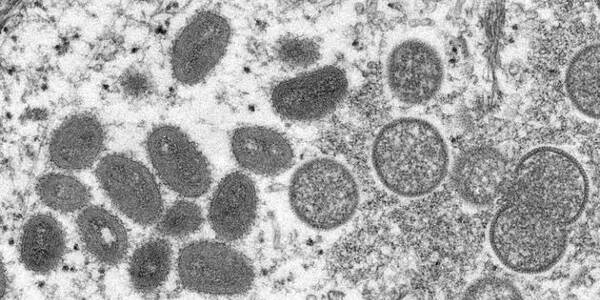 La variole du singe vue au microscope.
