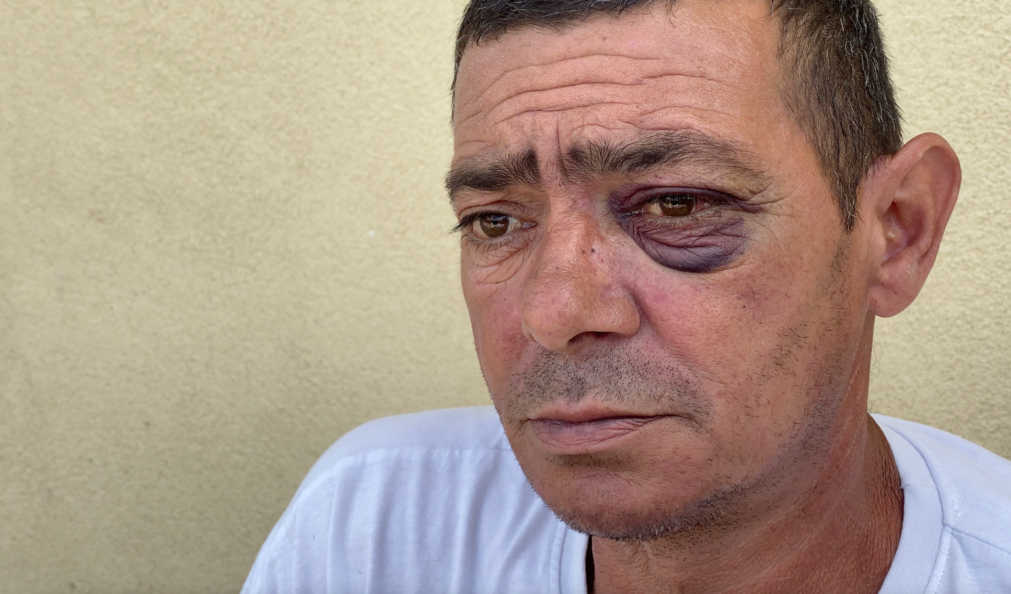 Une affaire de violences policières à Nice? Un habitant de l'Ariane accuse, la police répond