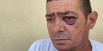Une affaire de violences policières à Nice? Un habitant de l'Ariane accuse, la police répond