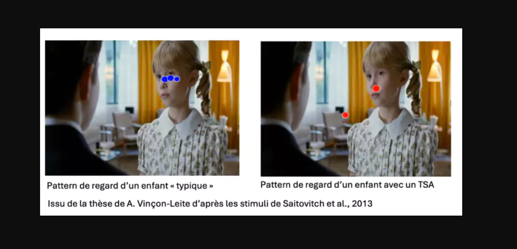 Autisme: l'hôpital de Pierrefeu dans le Var va étudier l'intérêt de l'eye-tracking pour guider les soins
