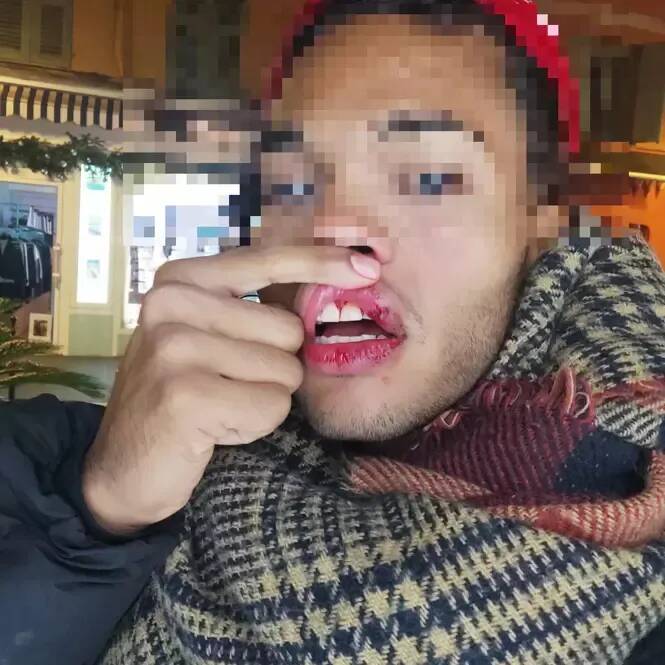 "Nous, les pédés, on les tue": ils avaient été frappés cours Saleya à Nice, le tribunal reconnaît le caractère homophobe de l'agression