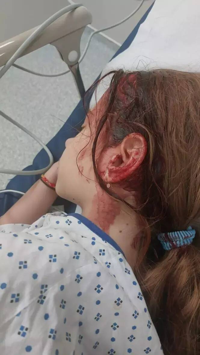 Famille agressée à Nice: polémique après la remise en liberté d'un des suspects