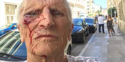 Le médecin violemment agressé à Nice vient de déposer plainte pour des insultes en ligne