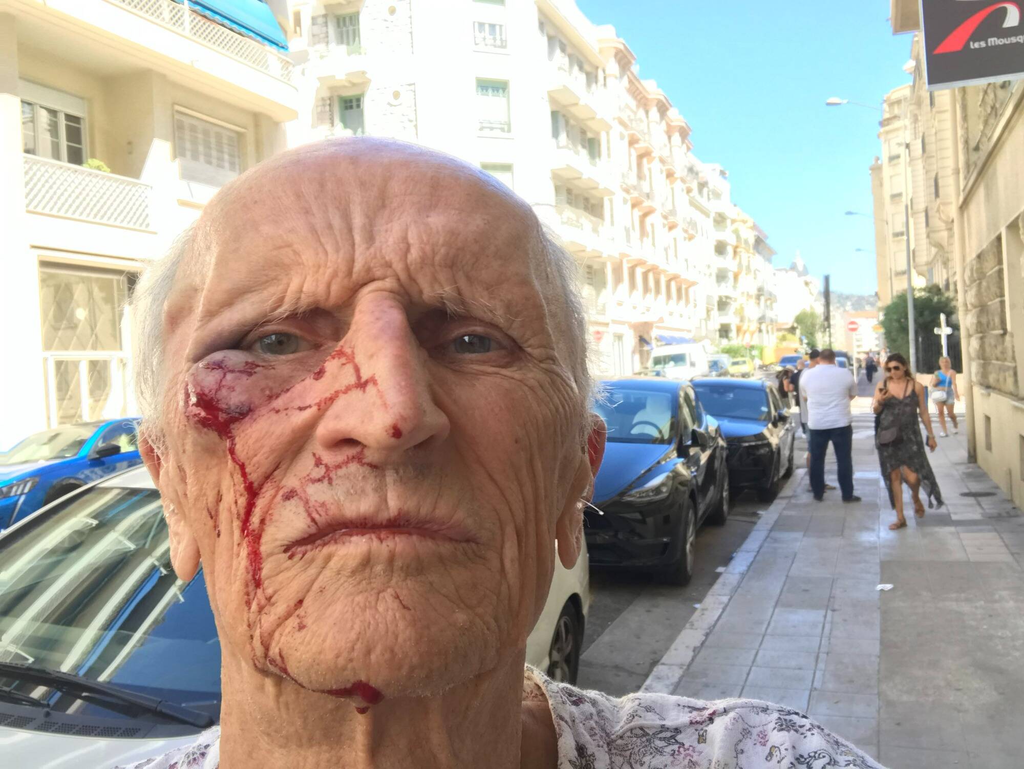 "J'ai cru qu'il allait me tuer": un médecin octogénaire violemment agressé lors d'une visite à domicile à Nice