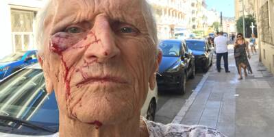 Un médecin octogénaire violemment agressé lors d'une visite à domicile à Nice