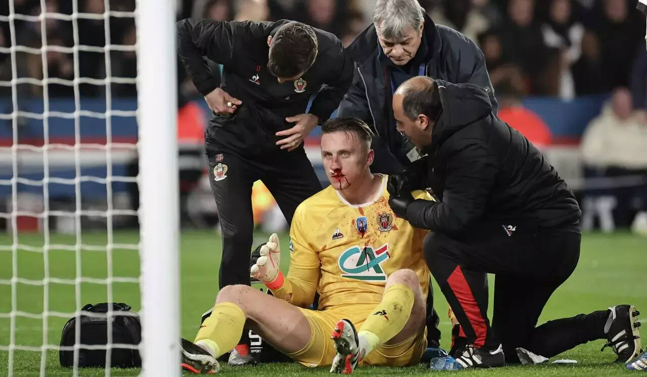 Euro 2024: ces joueurs qui ont très vite rejoué après une fracture du nez