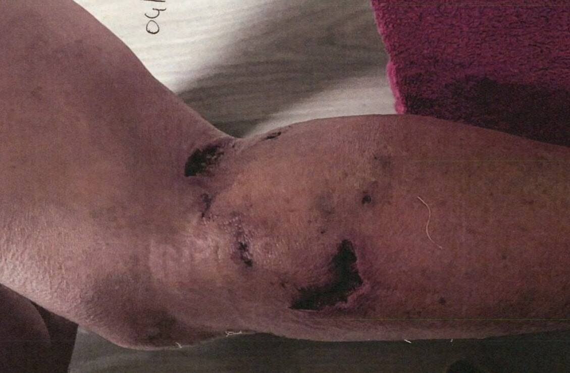 Une retraitée mordue par un Rottweiler sur la terrasse d'un café à Fréjus, le propriétaire du chien condamné