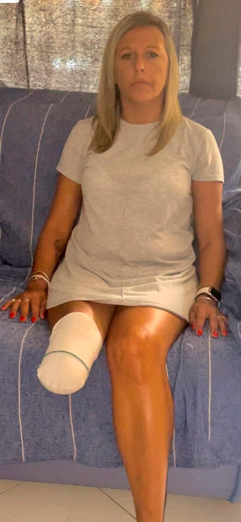 "Je suis anéantie": amputée après un accident avec un motard qui a été relaxé, elle se sent abandonnée