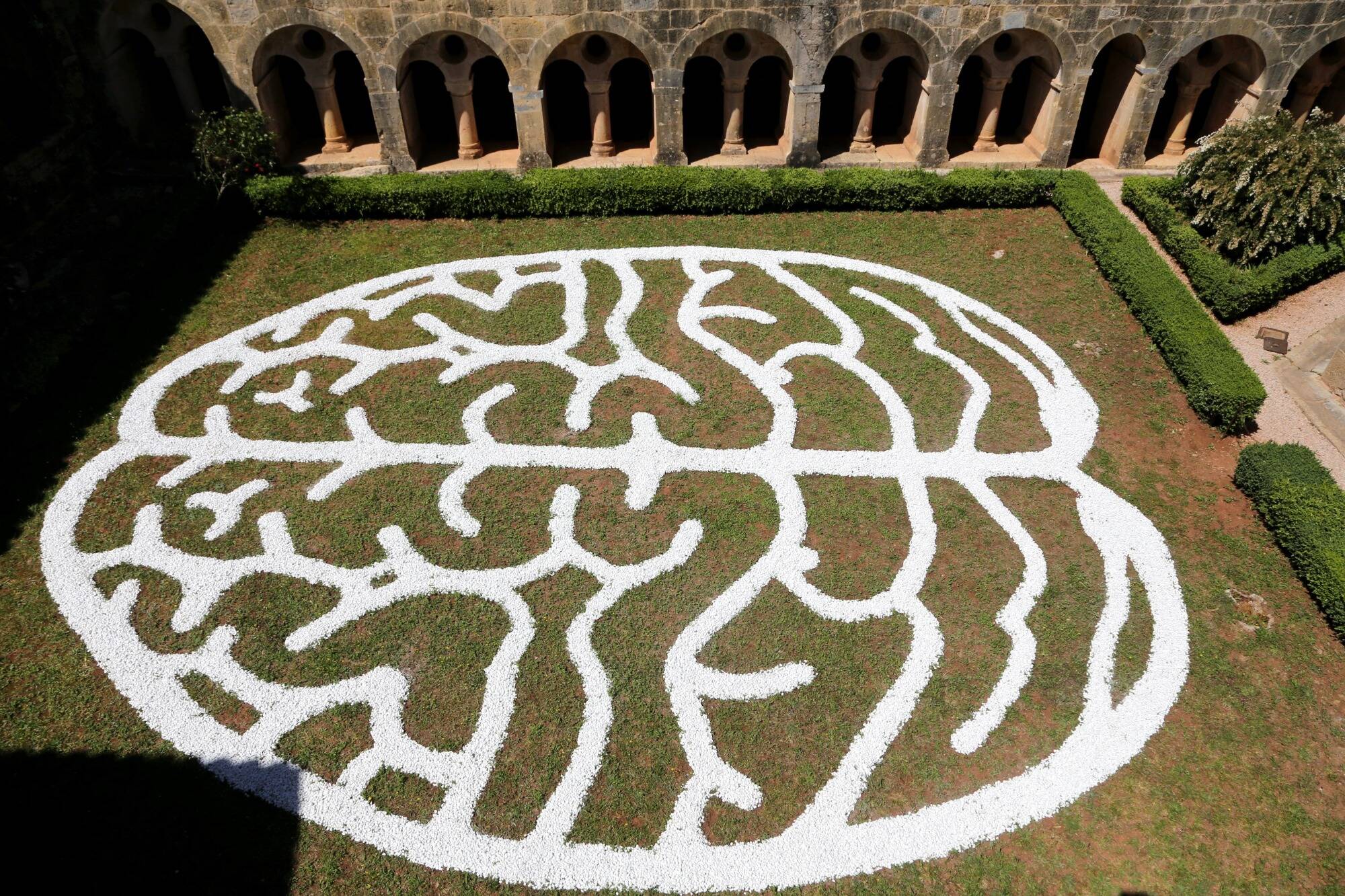 La start-up Neuralink de Musk va tester ses implants cérébraux sur des humains