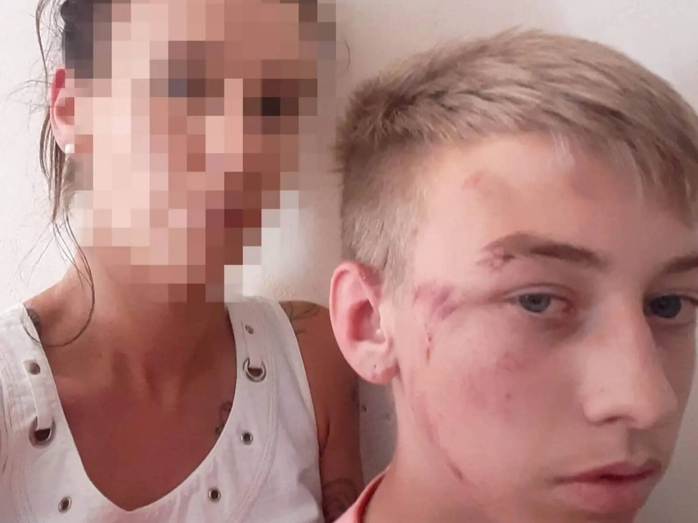 Furieuse Elle Raconte Comment Son Enfant A Ete Blesse En Jouant Au Reve Indien Qui Fait Le Buzz Sur Tik Tok Nice Matin Furieuse Elle Raconte Comment Son Enfant A Ete Blesse En Jouant Au Reve Indien Qui Fait Le Buzz Sur Tik Tok Nice Matin
