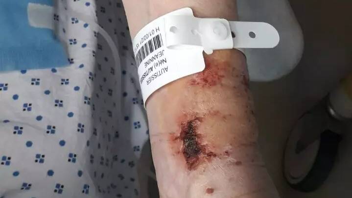 "Ils la regardaient en riant": elle affirme que sa mère a été frappée par des infirmières au CHU de Nice