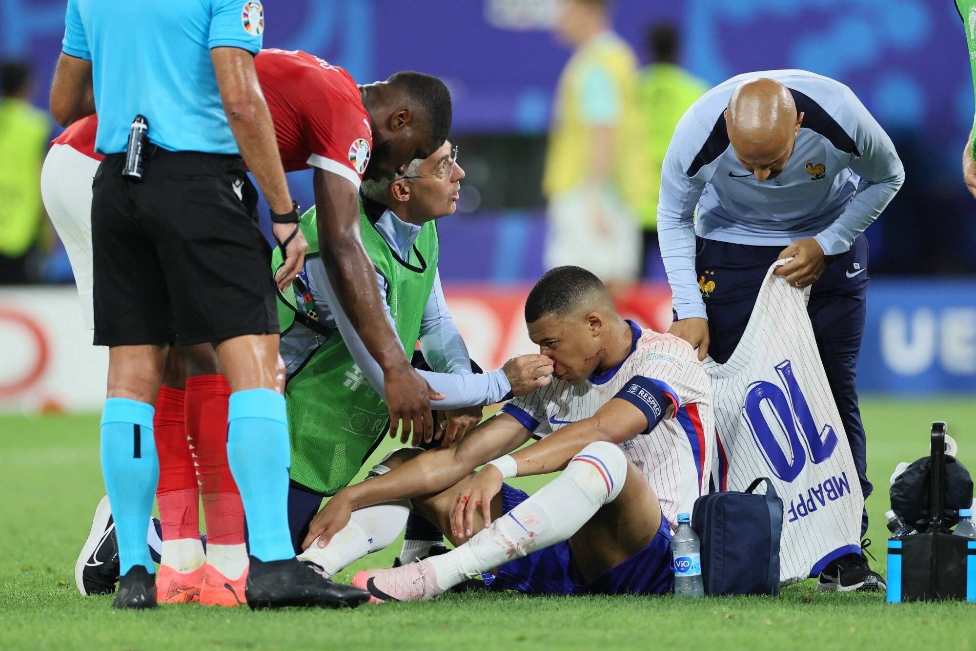 Euro-2024: inquiétude pour Mbappé sorti le nez en sang après la victoire de la France 1-0 contre l'Autriche