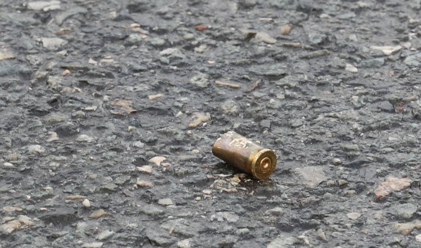 Il se présente aux urgences pour soigner un abcès, les médecins lui découvrent une balle logée dans le dos