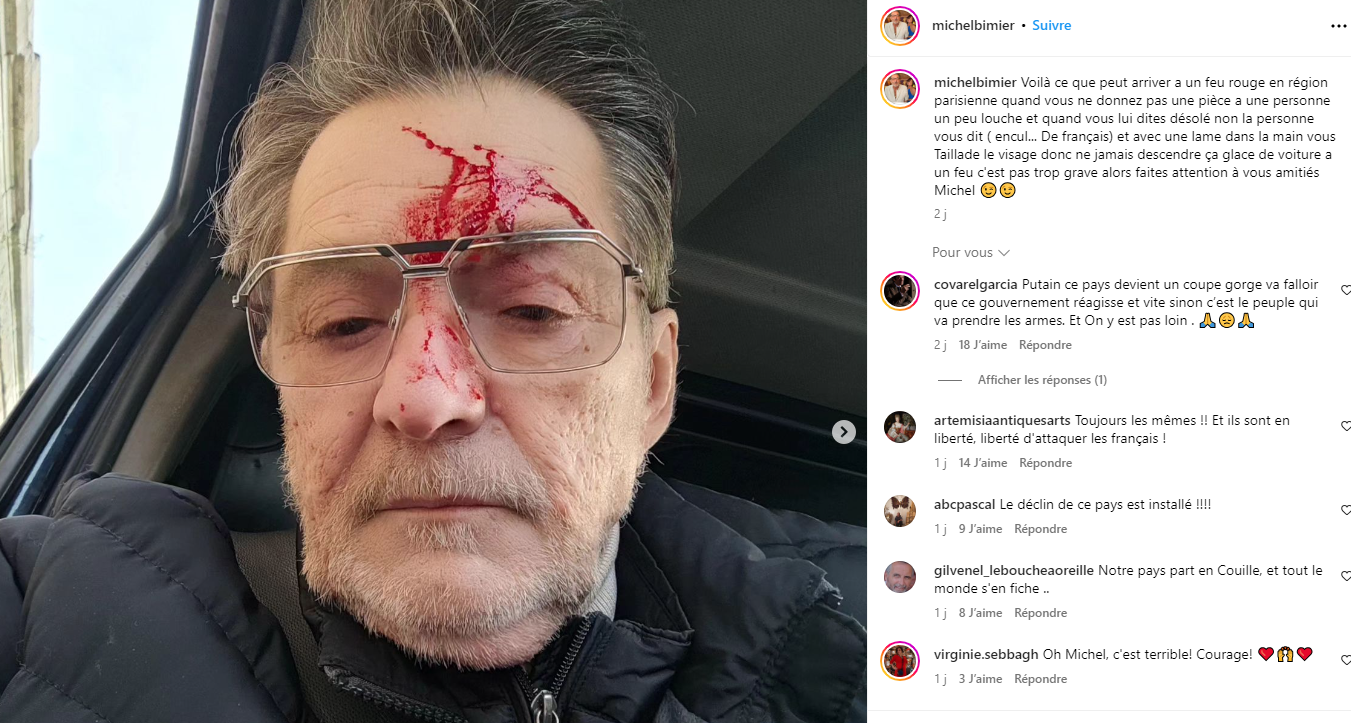 Un antiquaire star de l'émission "Affaire conclue" sur France 2 violemment agressé