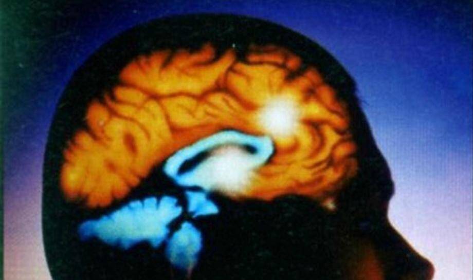 Nice accueille Neuroplanète, pour tout savoir (ou presque) sur les secrets du cerveau.