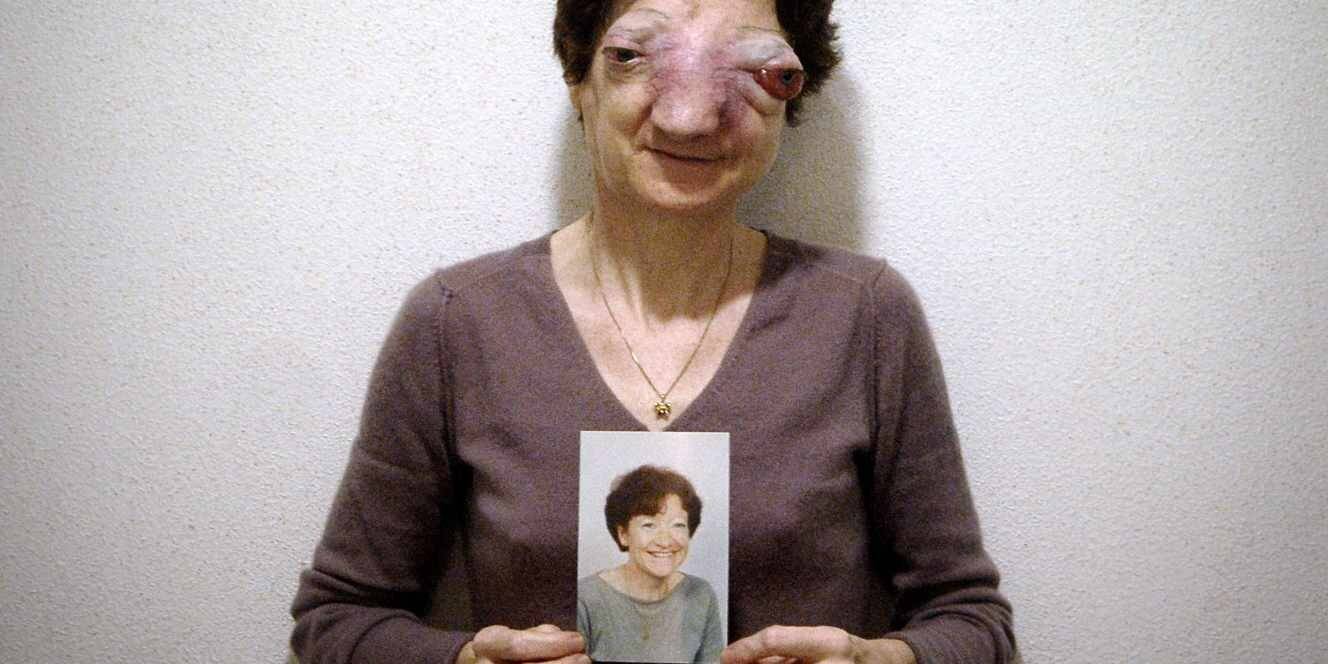 Elle voulait mourir dans la dignité, il y a quinze ans, Chantal Sébire se donnait la mort... Où en est aujourd'hui le débat sur l'euthanasie en France?