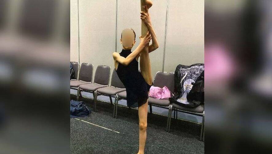 Retard de langage, fan des Télétubbies... Dénutrie et traitée comme une enfant, une ado pesait 27kg à 17 ans, ses parents condamnés