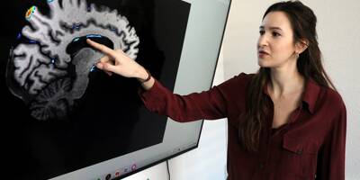 Comment cette chercheuse veut améliorer l'analyse des images IRM du cerveau