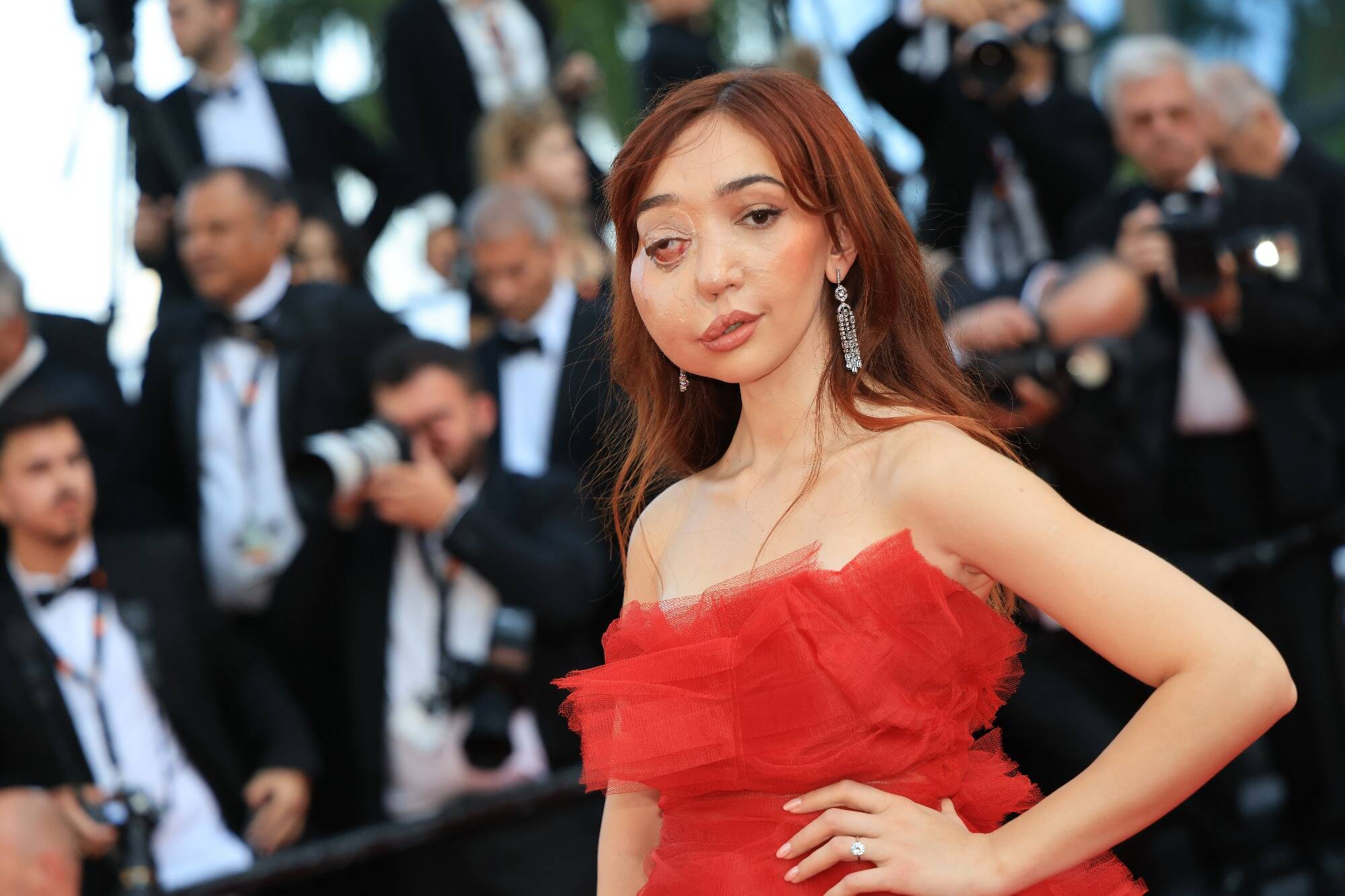 78e Festival de Cannes: qui est Nikki Lilly, cette jeune militante atteinte d'une maladie rare qui a foulé le tapis rouge mercredi soir?