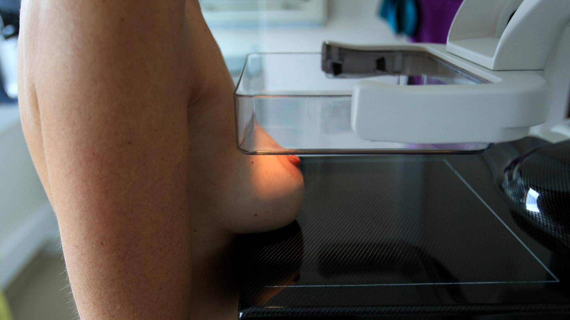 Comment contrer la participation trop faible au "dépistage organisé" du cancer du sein