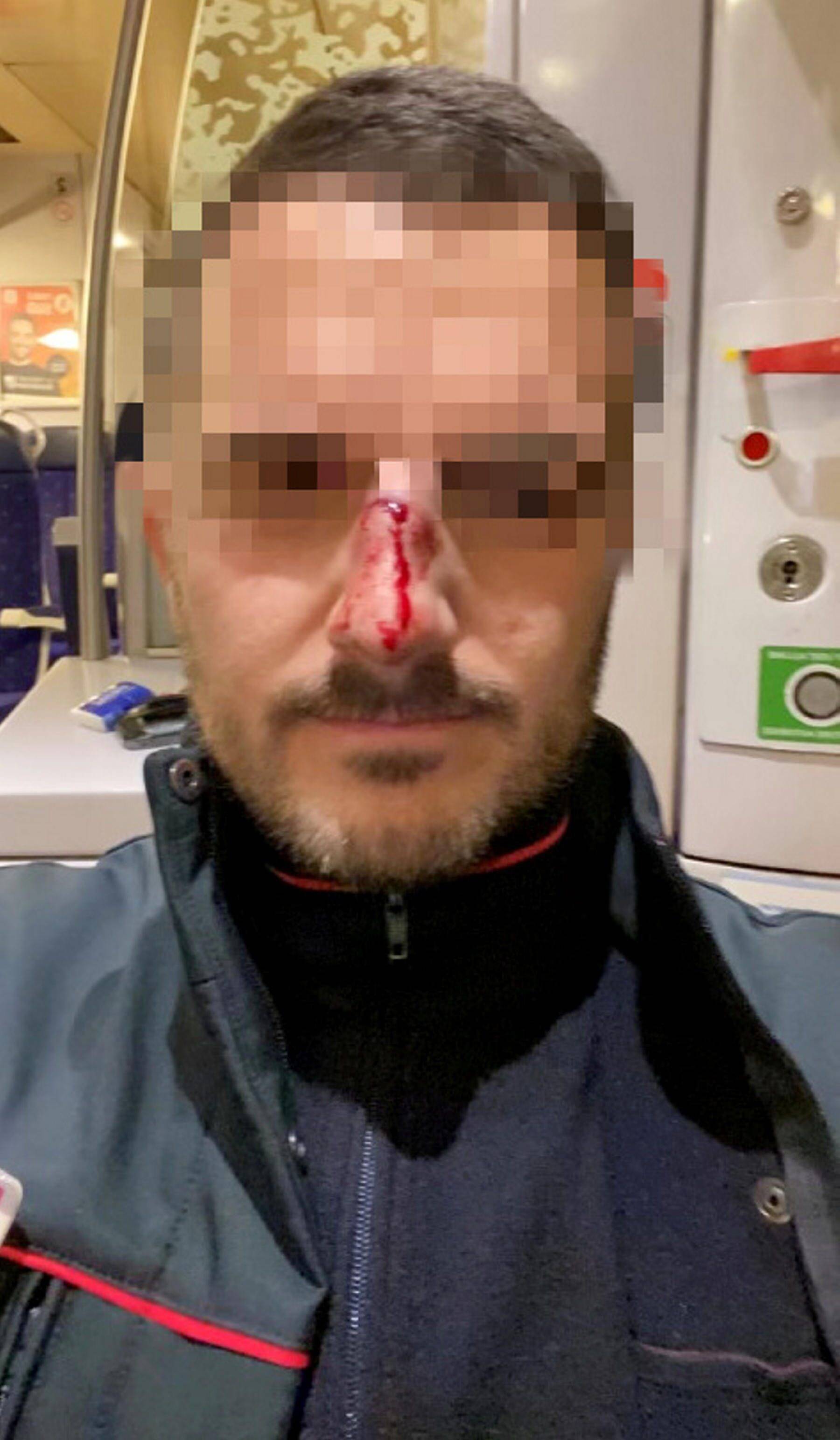 "Sans un mot, il me met un violent coup de tête": le contrôleur agressé à Cannes-La Bocca témoigne