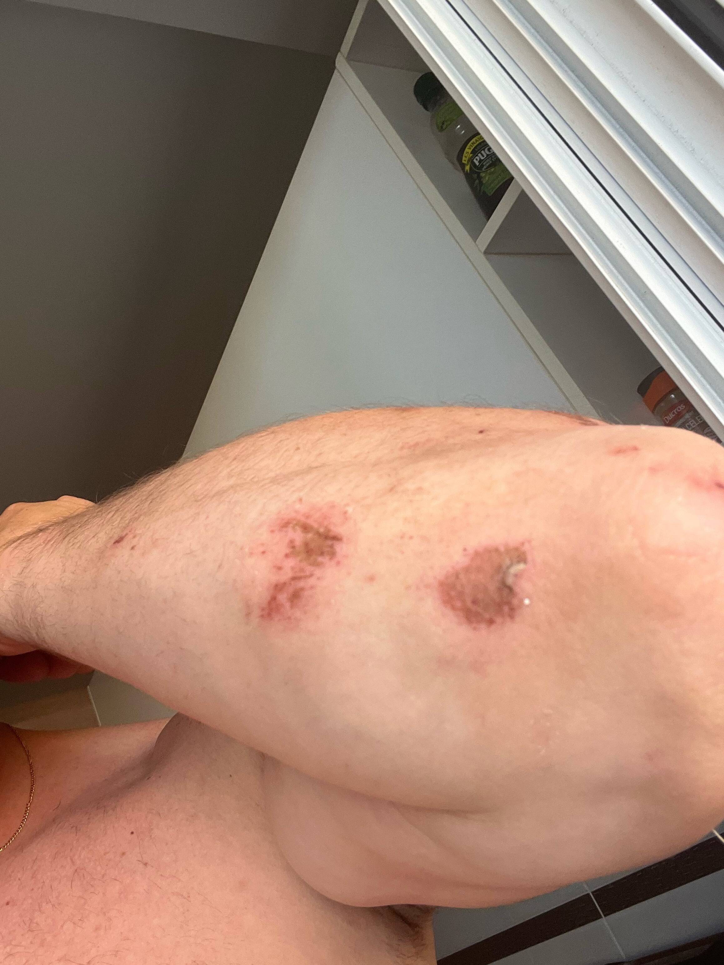 Un azuréen dépose plainte pour violences policières, alors qu'il est lui même poursuivi par les policiers pour avoir eu à un comportement violent