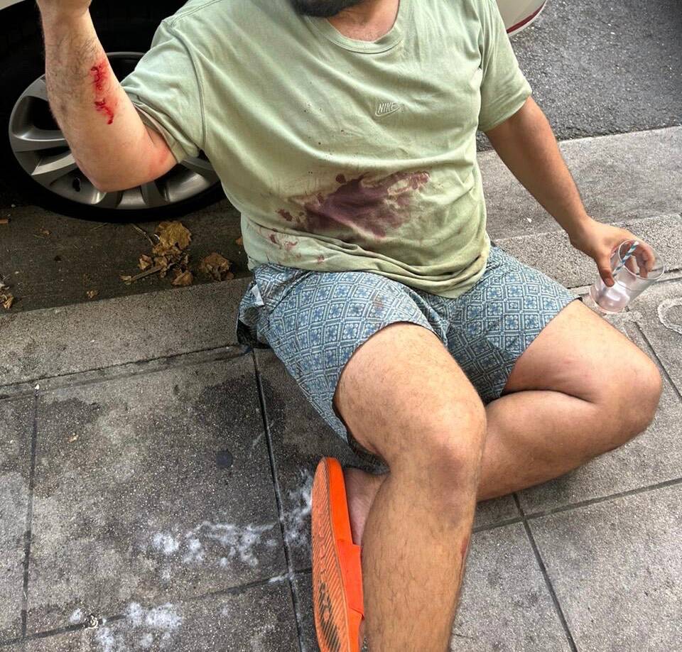 "Il a dit à son chien 'bouffe-le!'": un commerçant grièvement blessé par un pitbull dans le centre-ville de Nice