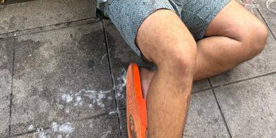 Un commerçant grièvement blessé par un pitbull dans le centre-ville de Nice