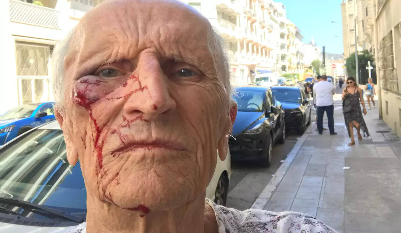 Sauvagement agressé à Nice pour avoir contrôlé un salarié en arrêt maladie, ce docteur a fait installer des caméras dans son cabinet