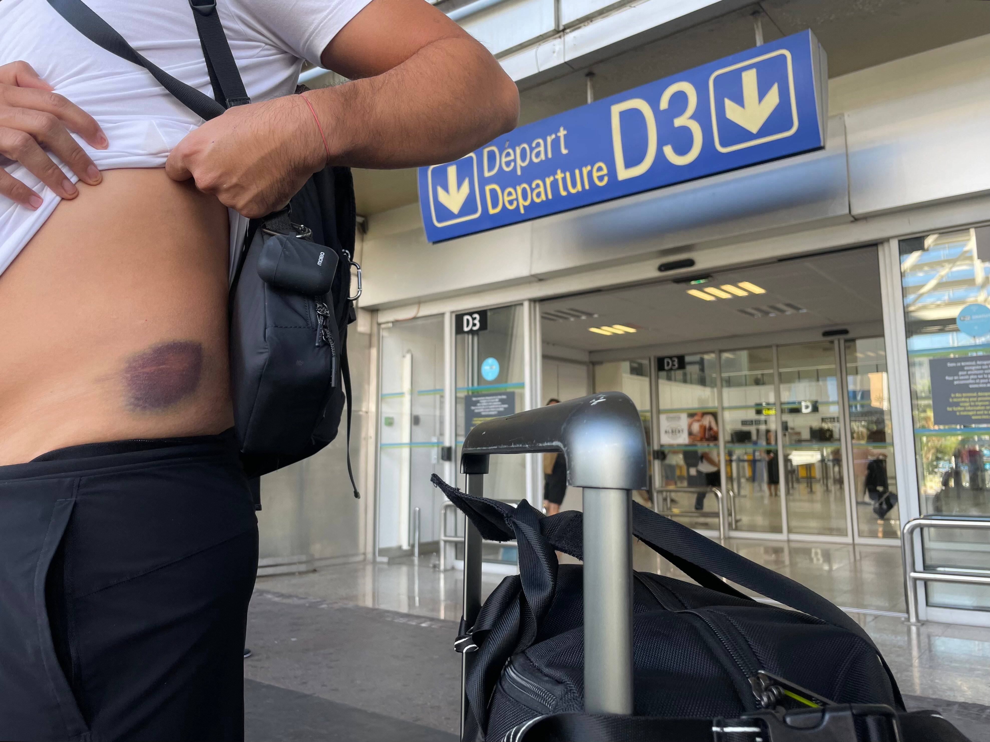 "Il m'a jeté au sol et frappé": ce touriste mexicain raconte le vol de sa montre à 50.000 euros en plein centre-ville de Nice