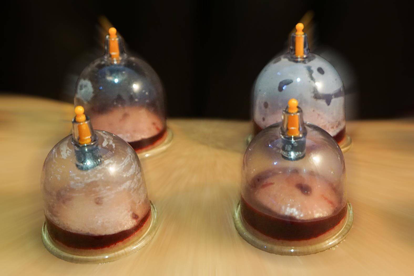 À Nice, une femme condamnée pour exercice illégal de la médecine après avoir pratiqué des soins alternatifs en vogue dans la communauté musulmane