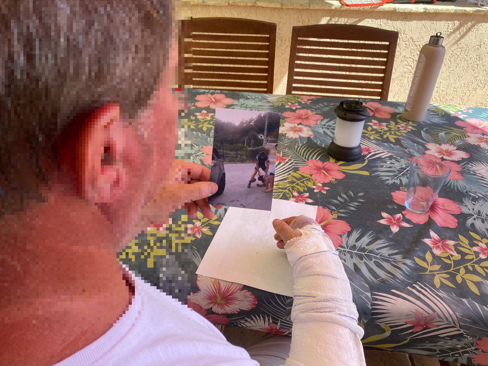 "J'ai cru qu'ils allaient le tuer": il se fait agresser parce qu'il demandait à des jeunes de rouler moins vite