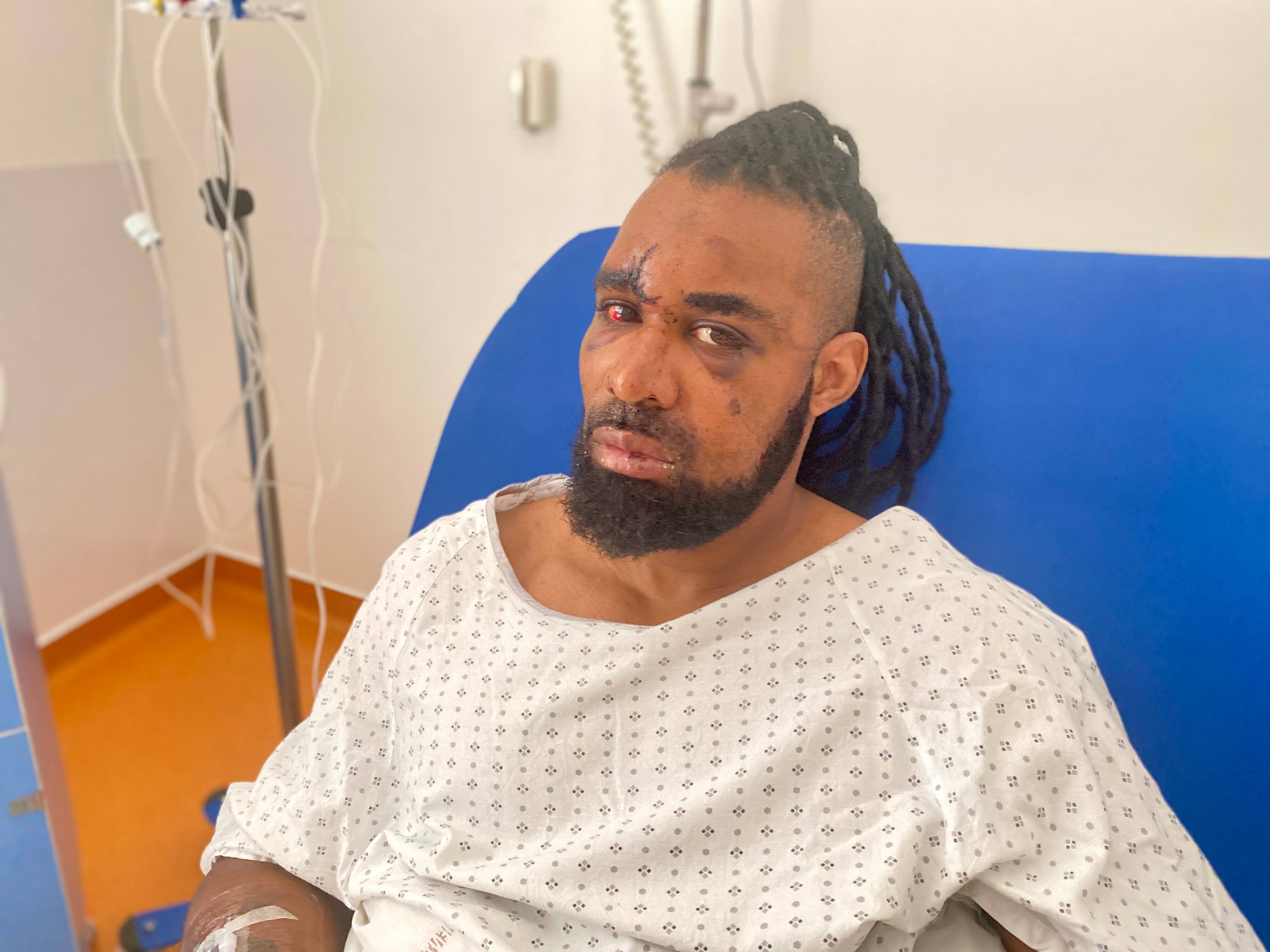 "Je me suis vu mourir, roué de coups sur le bitume...": il raconte sa violente agression à Cannes dans la discothèque où il travaille