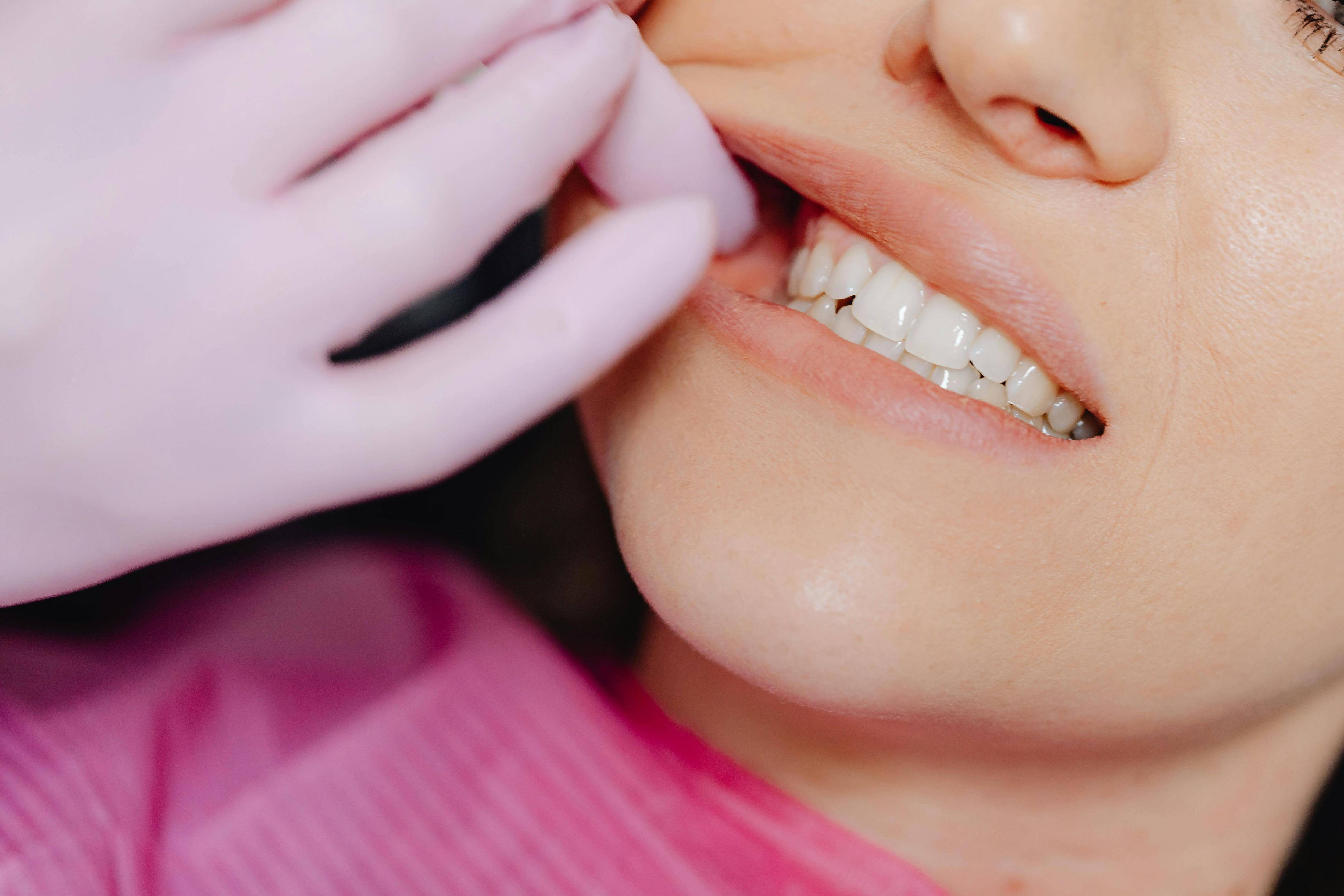 Entre promesses et réalité: ce qu'il faut savoir avant de faire un éclaircissement des dents