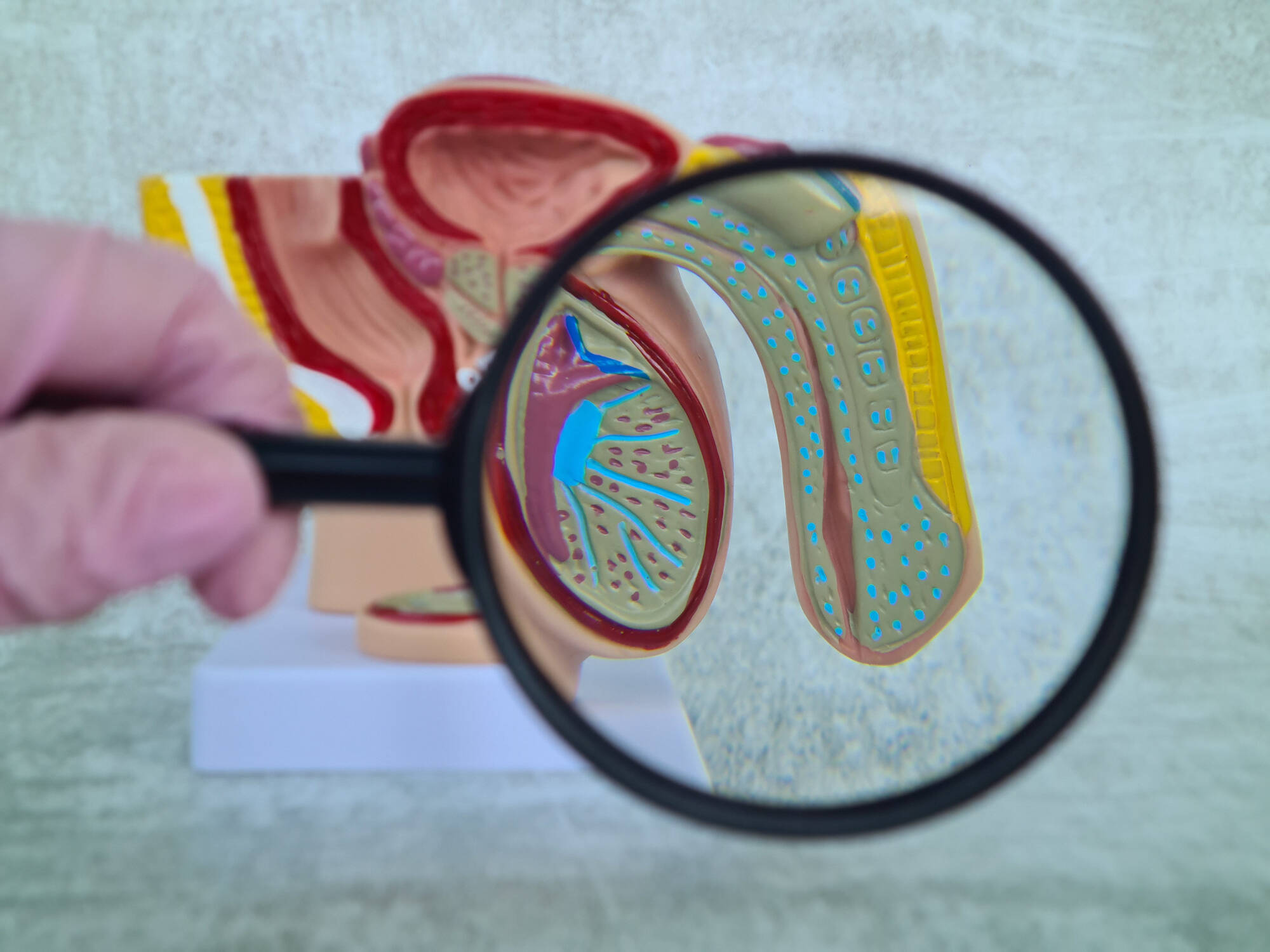 "500 nouveaux cas par an": Le cancer de la verge souvent lié au papillomavirus