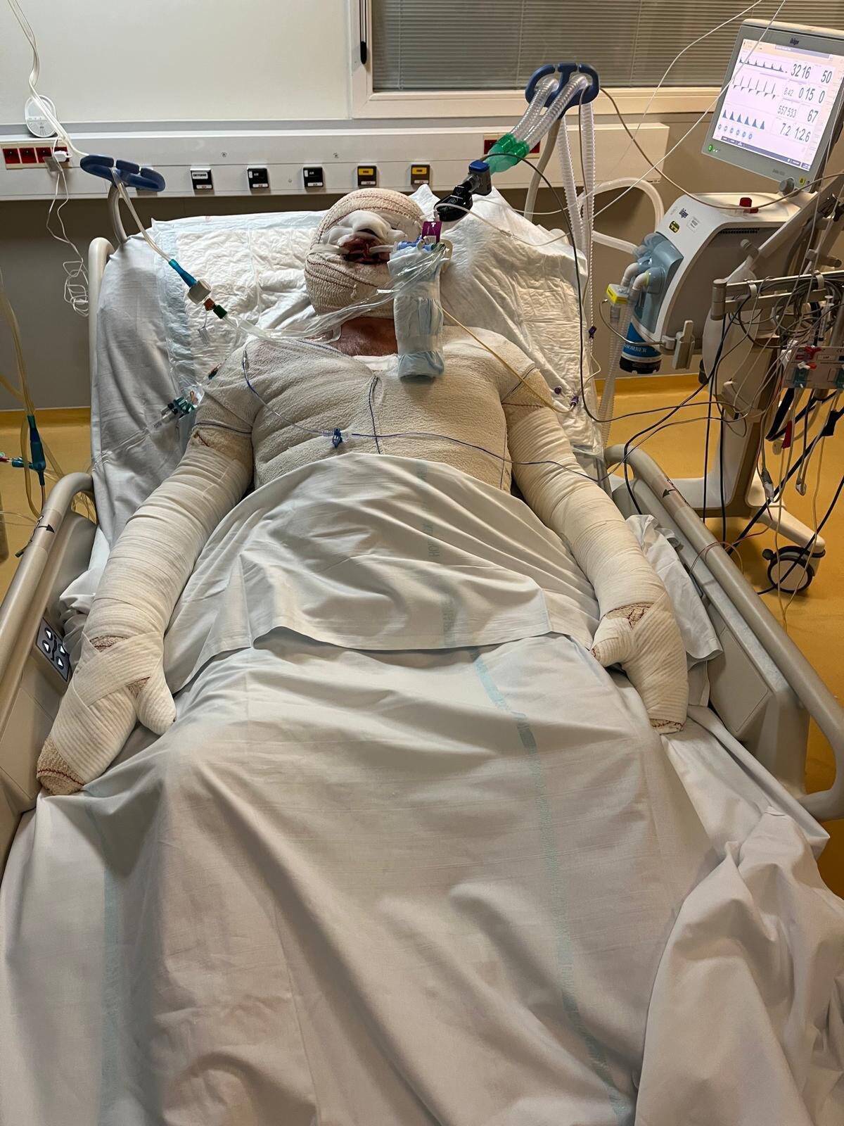 "Il ne peut pas parler, mais il doit penser qu'il est paralysé": les familles des brûlés par une lampe à éthanol dans un restaurant de Cannes témoignent