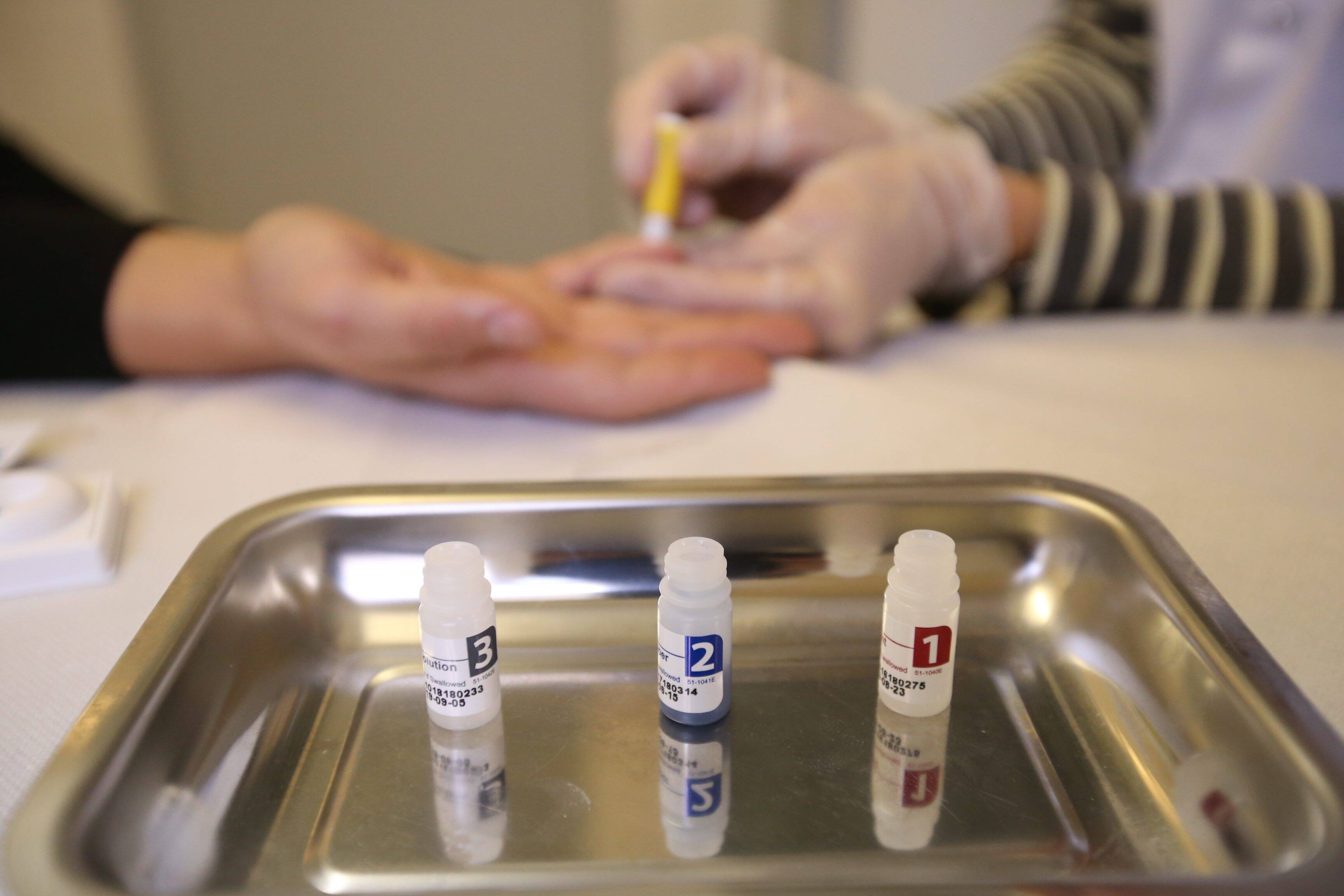 "L'épidémie de VIH n'est pas en recrudescence, mais elle ne recule plus", le Dr Eric Cua du CHU de Nice dresse un état des lieux préoccupant