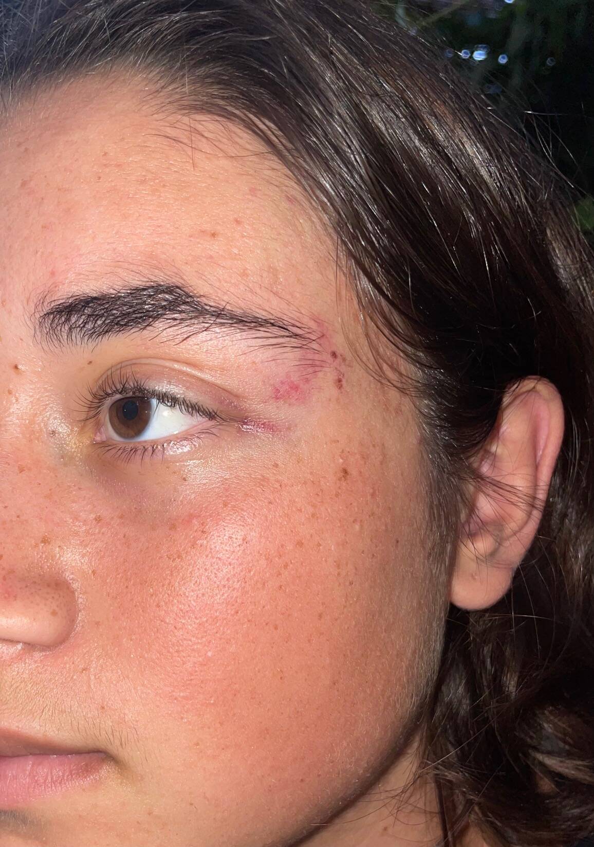 "J'ai protégé ma tête. Ils m'ont rouée de coups": elle raconte son agression à la Fête de la musique à Cannes