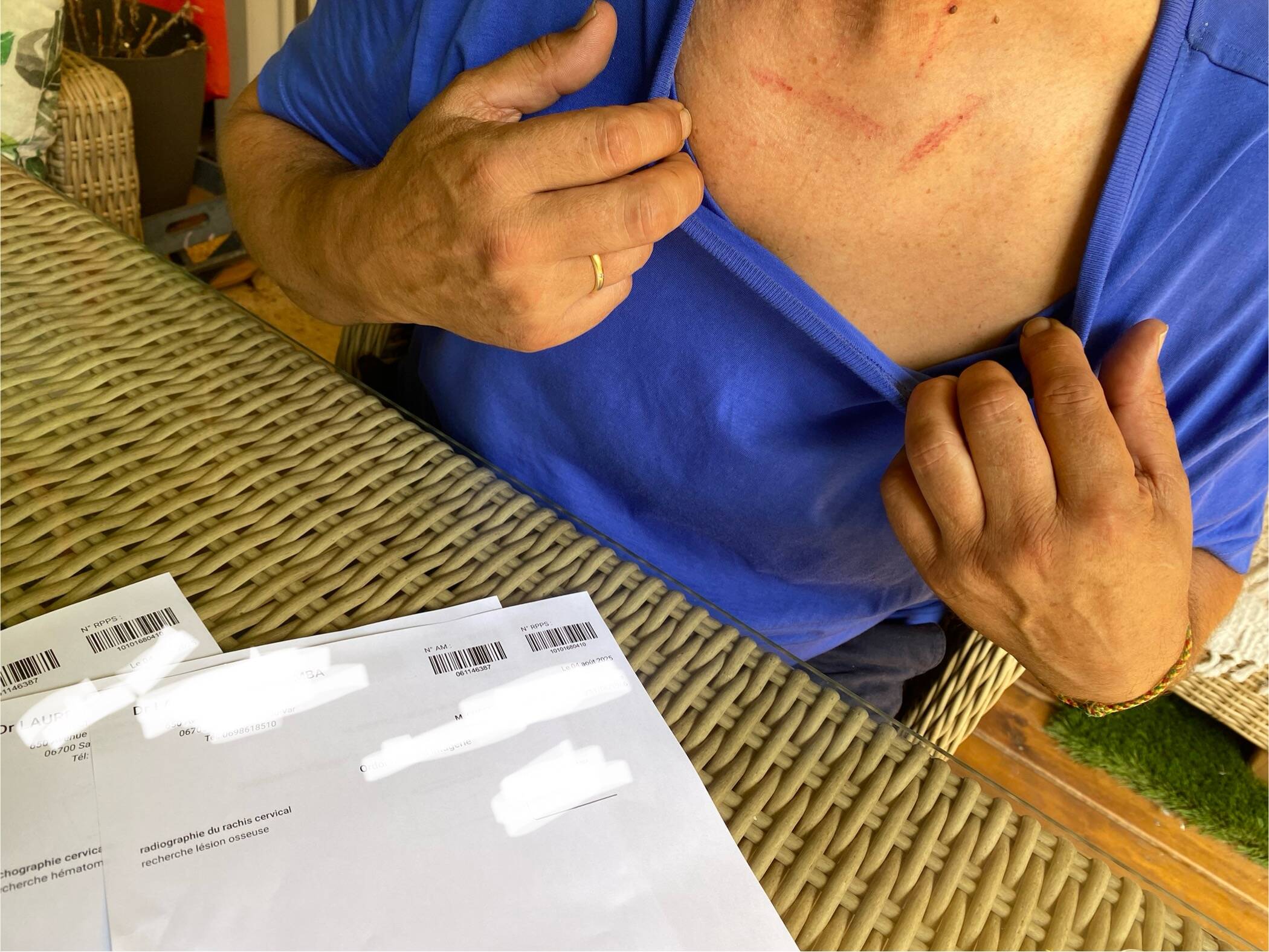 Un Azuréen porte plainte pour violences contre l'acteur de "Taxi" Samy Naceri