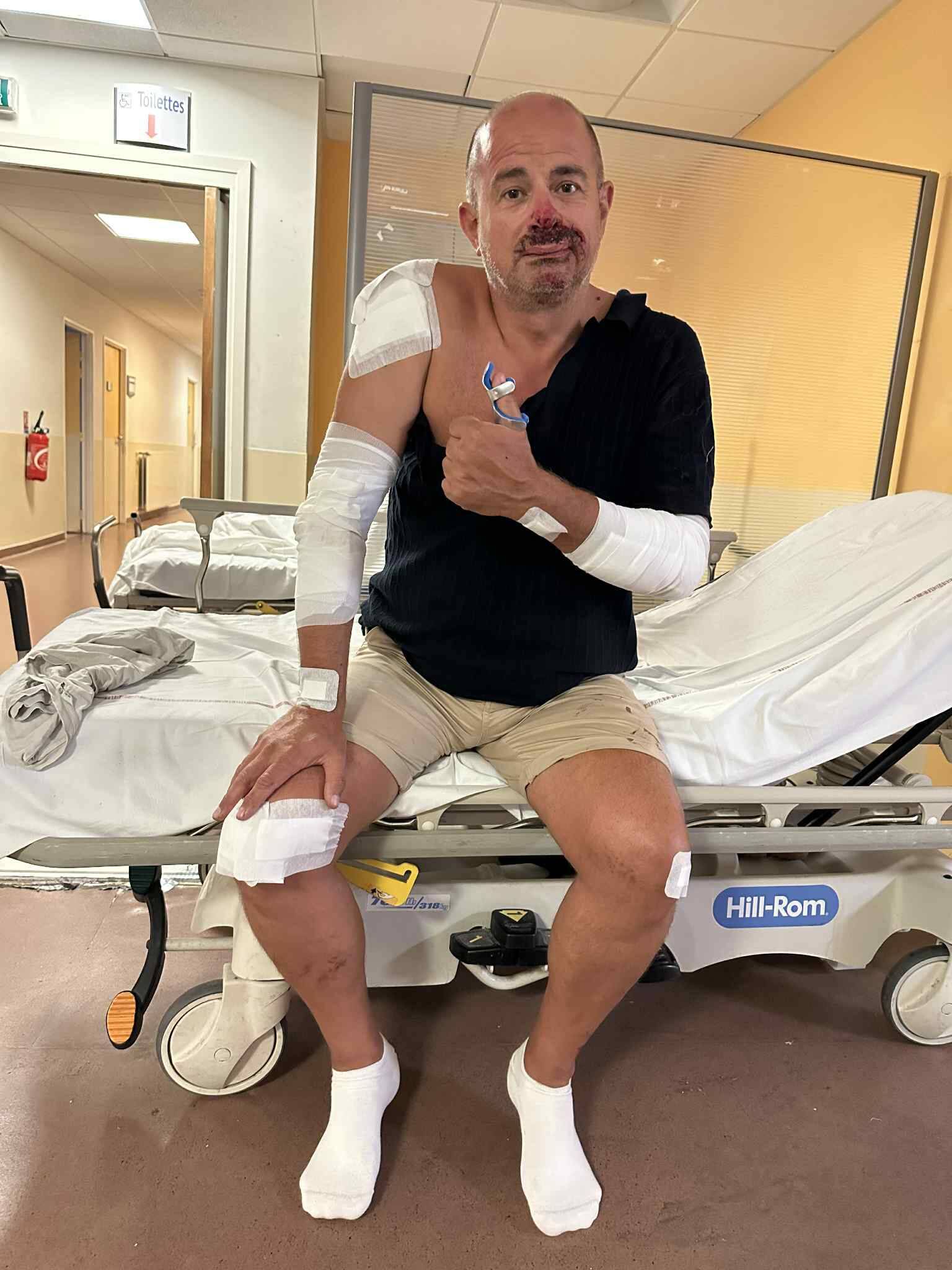 "J'ai deux côtes, une dent et un orteil cassés": un Azuréen blessé après avoir percuté un sanglier en deux-roues