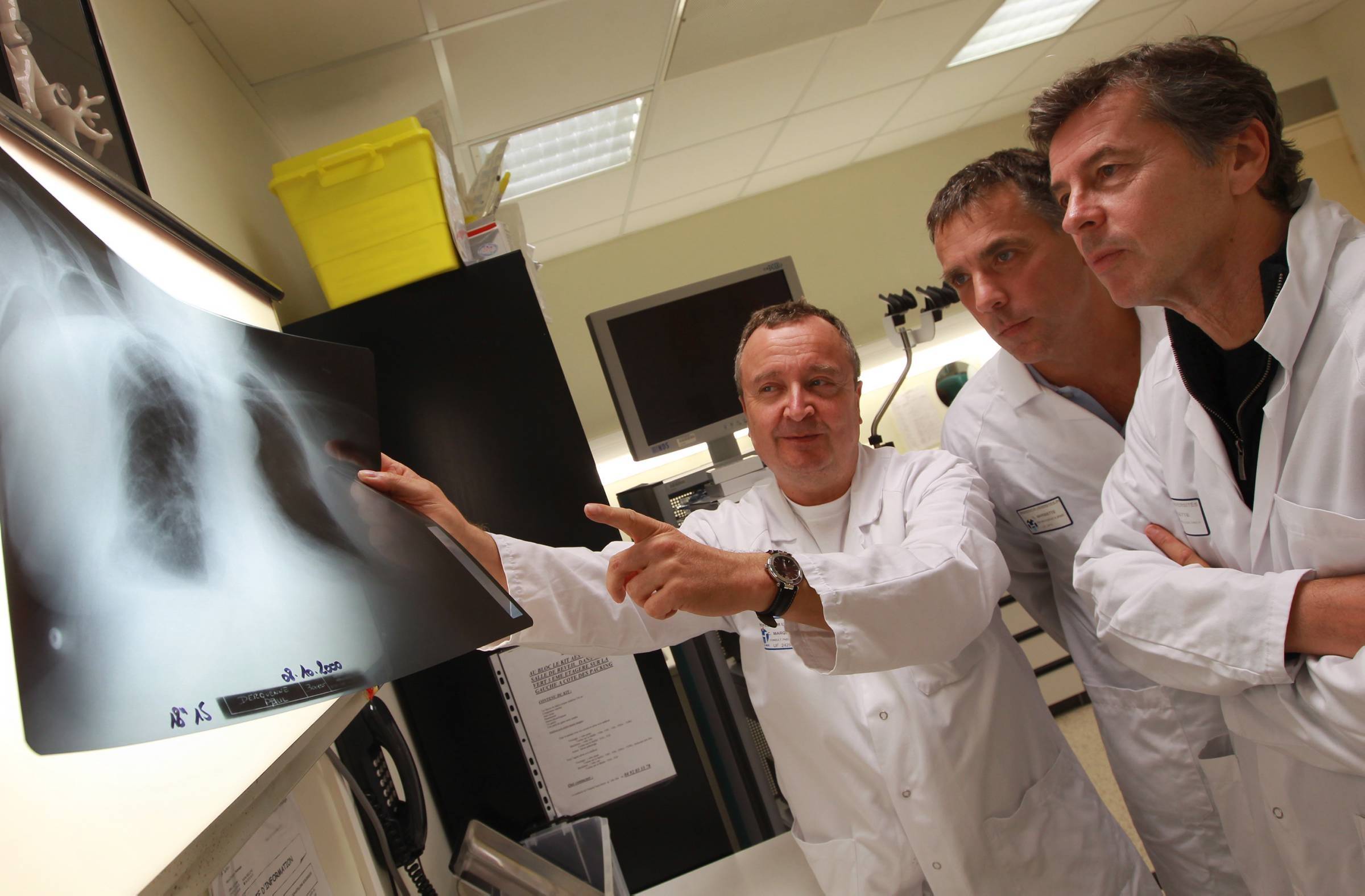 Fumeurs ou ex-fumeurs: pourquoi et quand faut-il faire un dépistage du cancer du poumon?