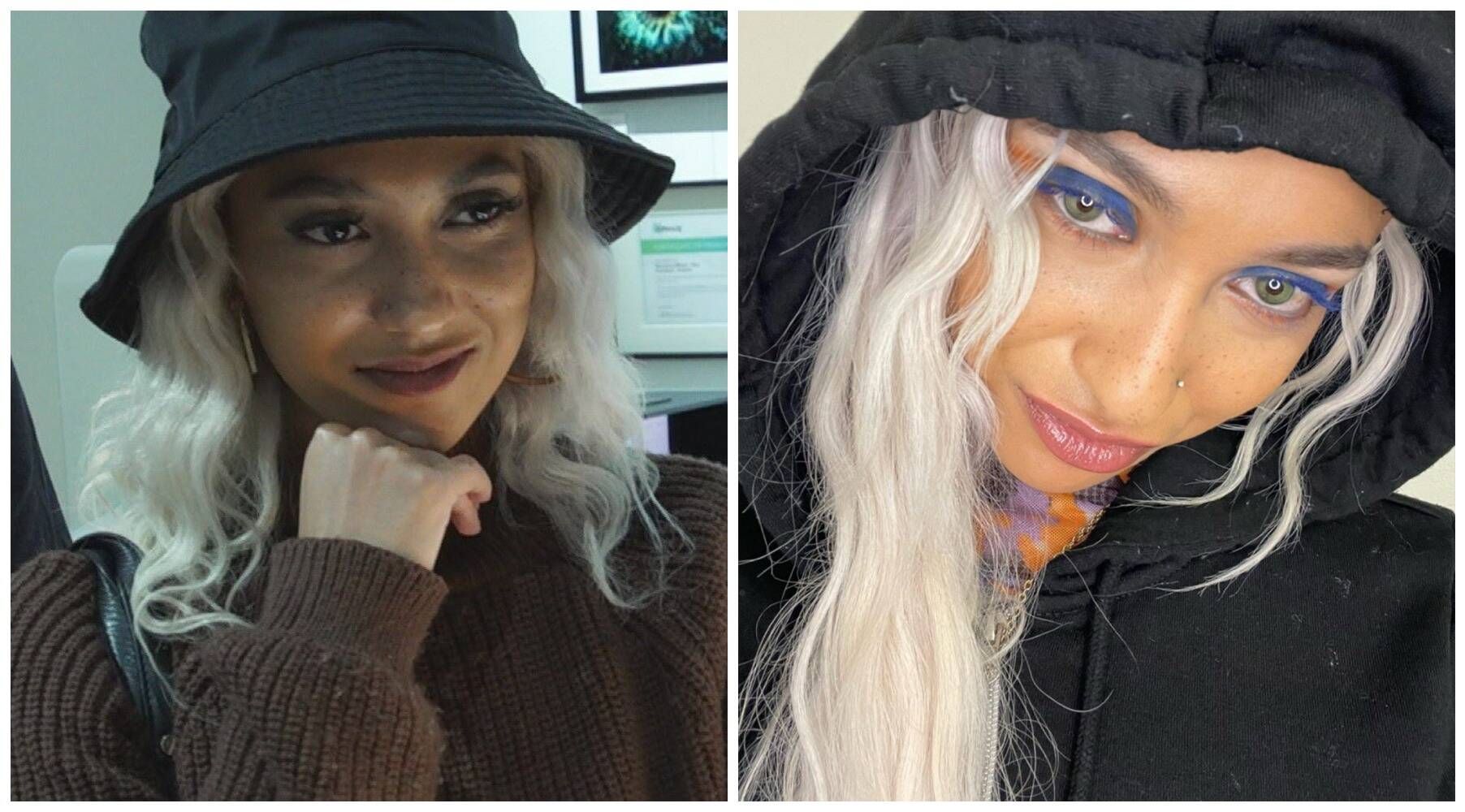 Chirurgie esthétique: cette jeune Niçoise a changé la couleur de ses yeux, elle témoigne en prime time sur M6