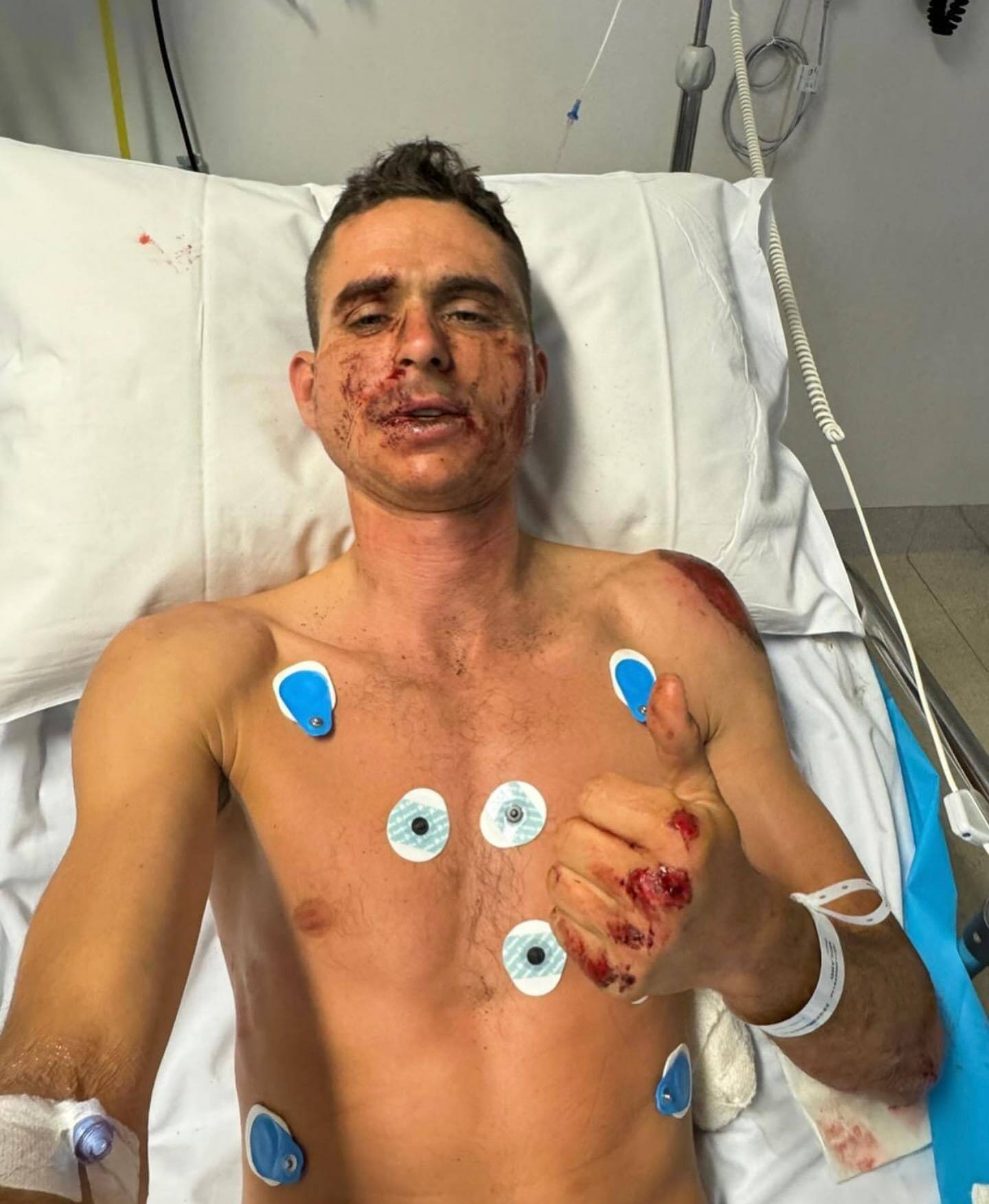 Le cycliste azuréen Rudy Molard victime d'une lourde chute en Australie