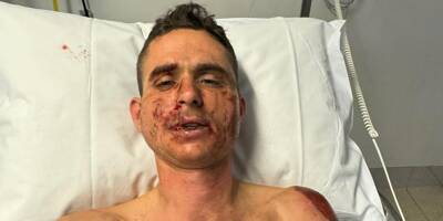Le cycliste azuréen Rudy Molard victime d'une lourde chute en Australie
